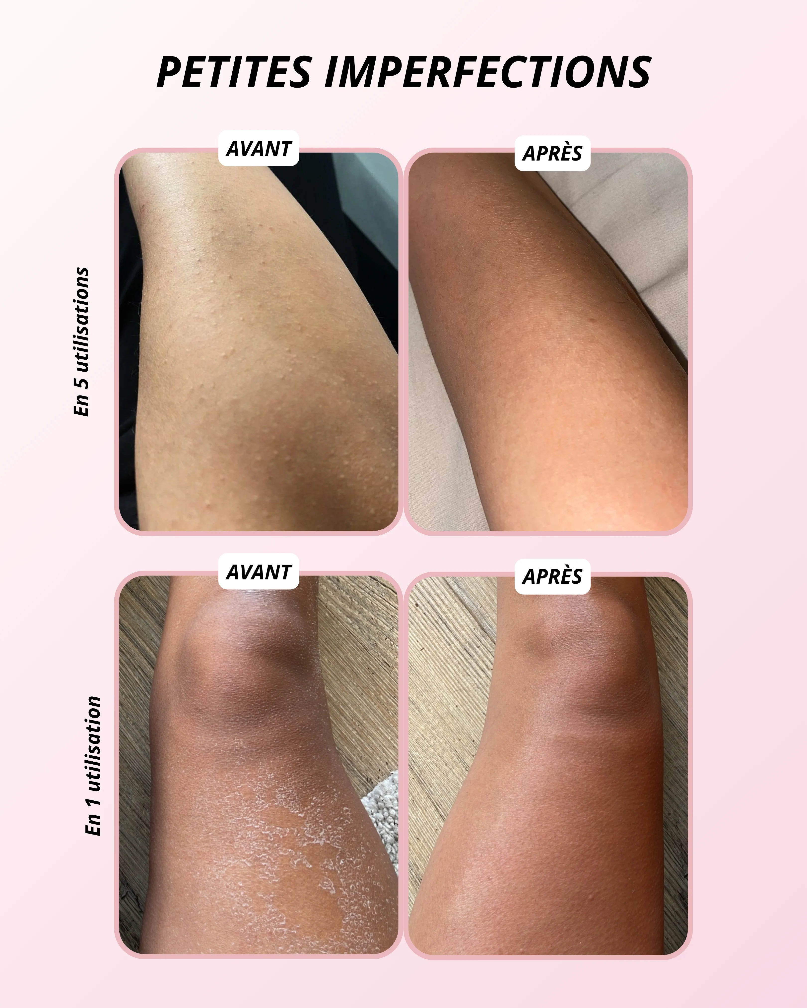 Gant Exfoliant en Soie - Corps